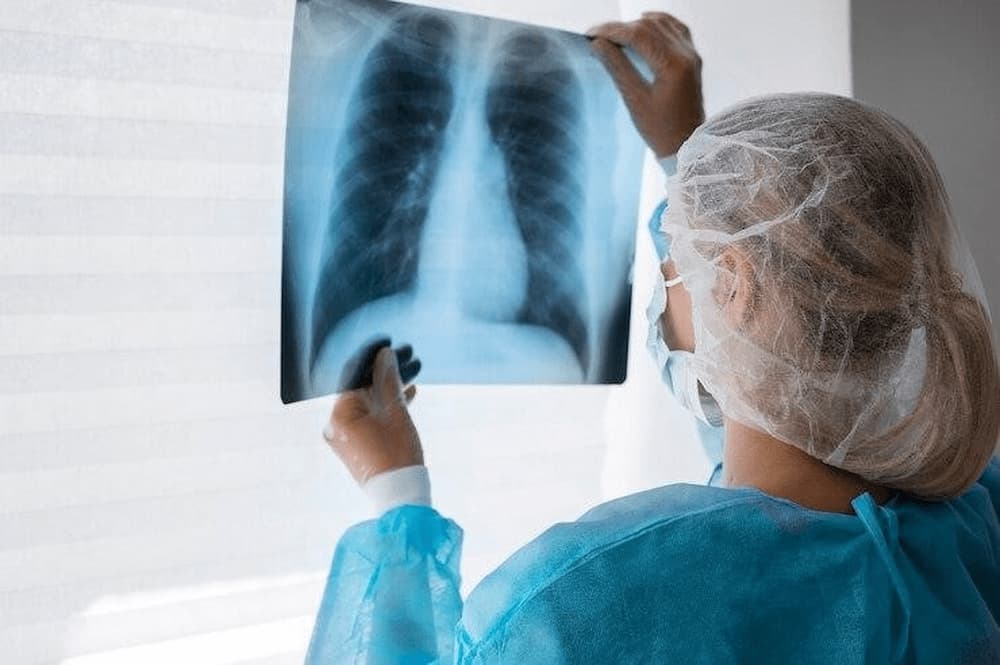 Radiografía en pulmones